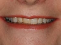 Konig Center for Cosmetic & Comprehensive Dentistry smile photos